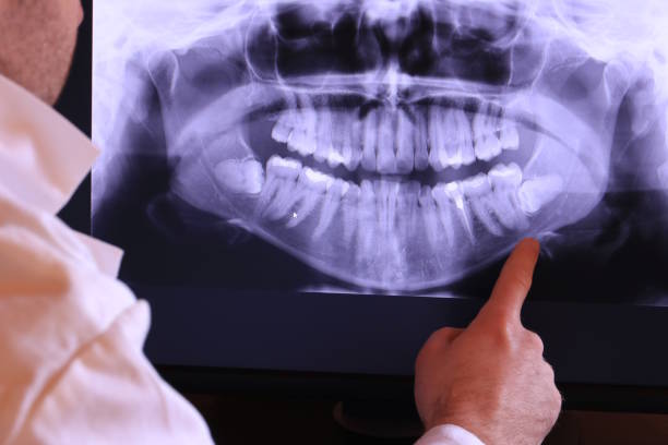 Best Cosmetic Emergency Dentistry in Martha Lake, WA