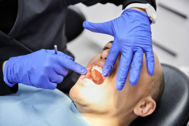 Best Emergency Treatment for Dental Infections or Abscesses in Martha Lake, WA